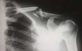 Emergency X-Rays for Radiographers